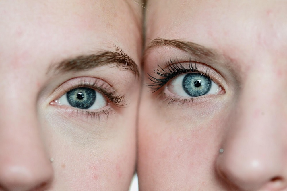 The Plus Sides Of Having Your Eyes Double In Size Surgically