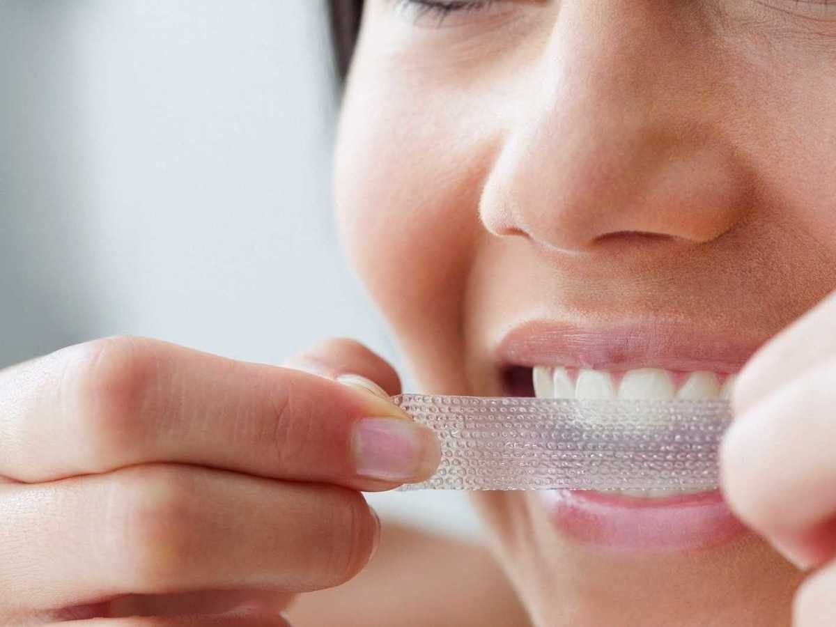 Your Ultimate Guide to Teeth Whitening