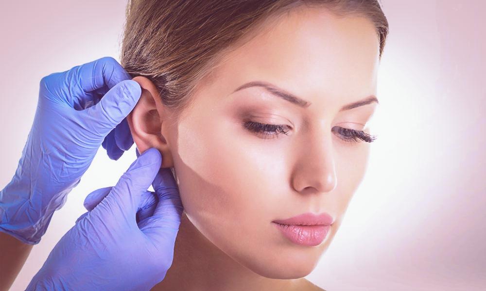 Sculpting Perfection: The Art of Ear Reshaping in London