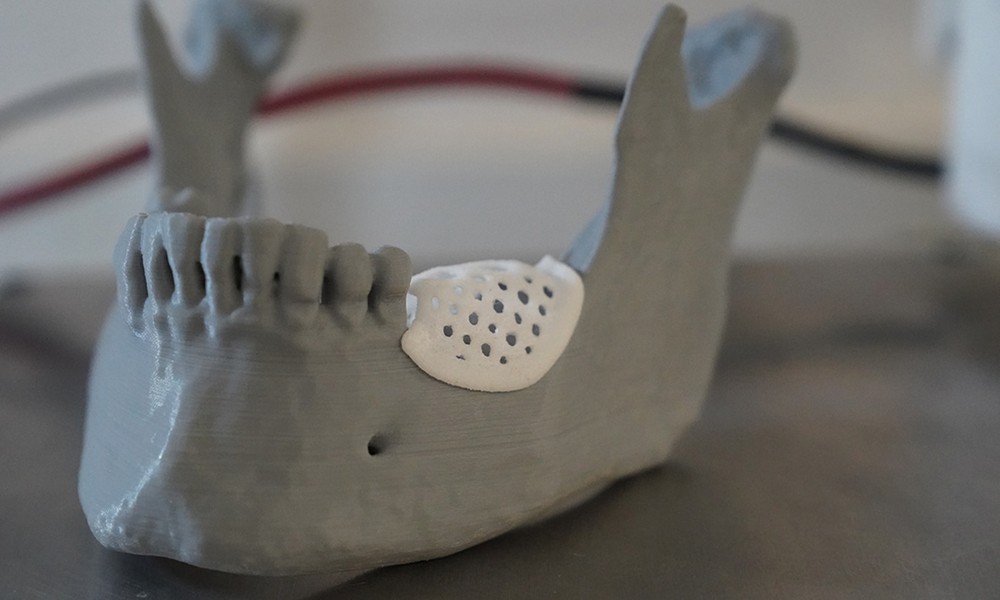 How Advanced 3D Printing Materials Are Transforming Guided Dental Procedures